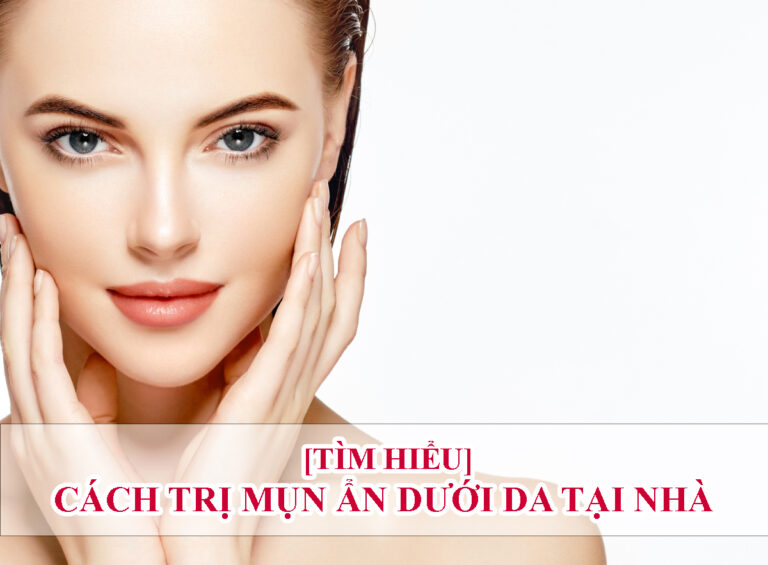 cách trị mụn ẩn dưới da tại nhà