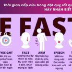 fast trong đột quỵ