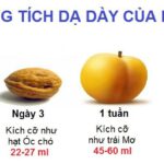 thể tích dạ dày trẻ sơ sinh